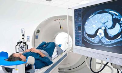 CT-scan (stock - rechtenvrij)